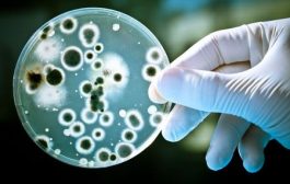 Amalgam fillings with mercury linked to antibiotic resistant bacteria