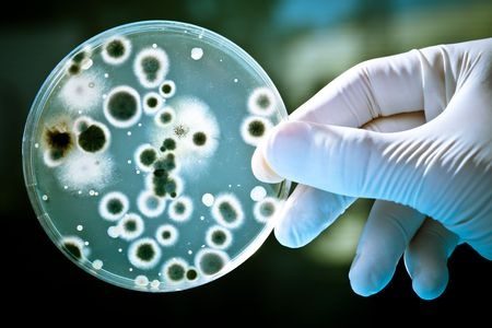 Amalgam fillings with mercury linked to antibiotic resistant bacteria