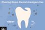 Lessons from Countries Phasing Down Dental Mercury Amalgam Filling Use