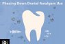 Lessons from Countries Phasing Down Dental Mercury Amalgam Filling Use